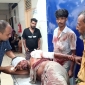 রাঙ্গুনিয়াতে গরু বাজারে দুই পক্ষের রক্তক্ষয়ী সংঘর্ষ : আহত-৩