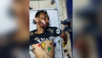 কাপ্তাই সড়কে বাস- মোটরসাইকেল সংঘর্ষে পা বিচ্ছিন্ন হয়ে যুবকের মৃত্যু